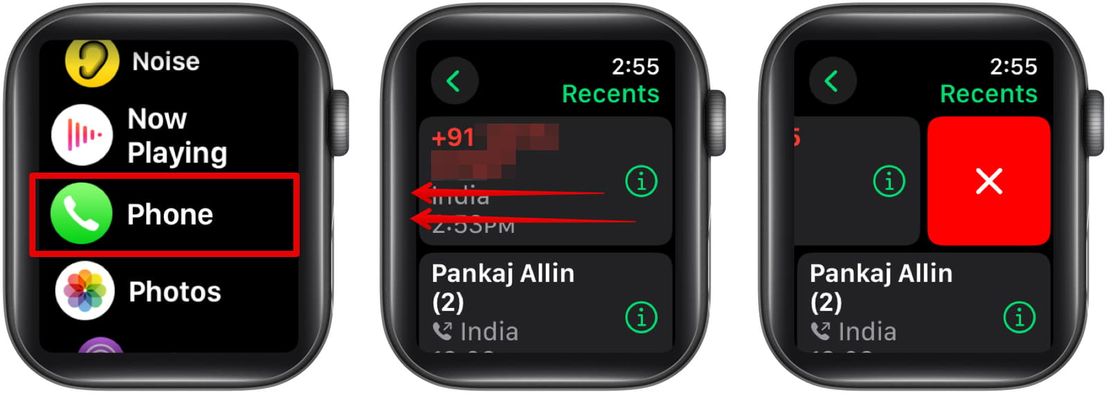 Deleting a recent call in the Phone app on an Apple Watch.