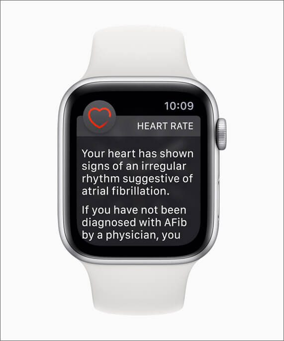 Irregular Rhythm Notification on Apple Watch Series 4