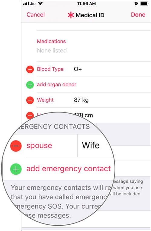 Add Emergency Contact in iPhone Health App