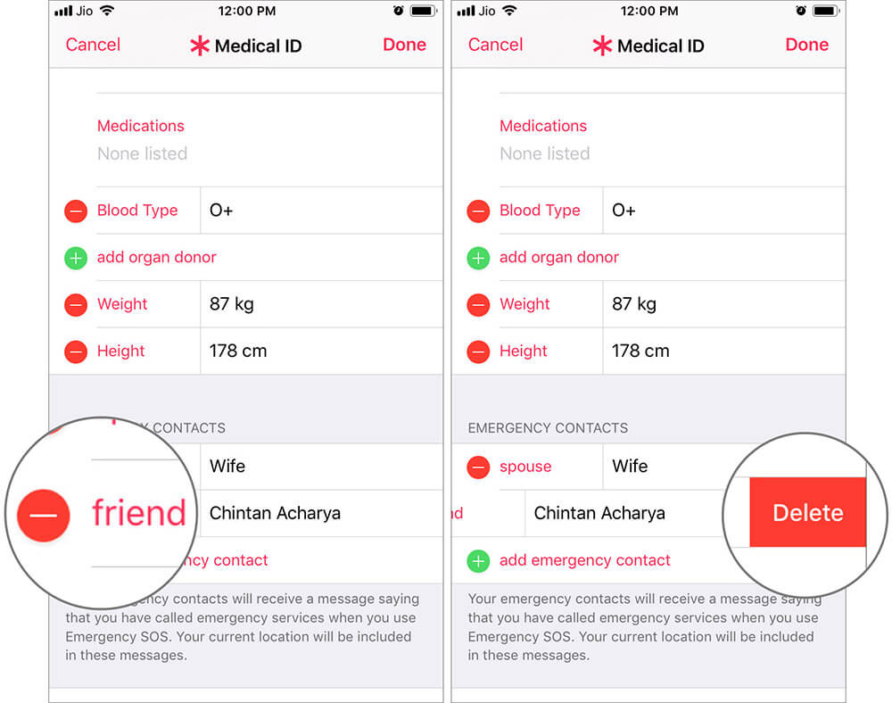 Remove Emergency SOS Contact from Health App on iPhone