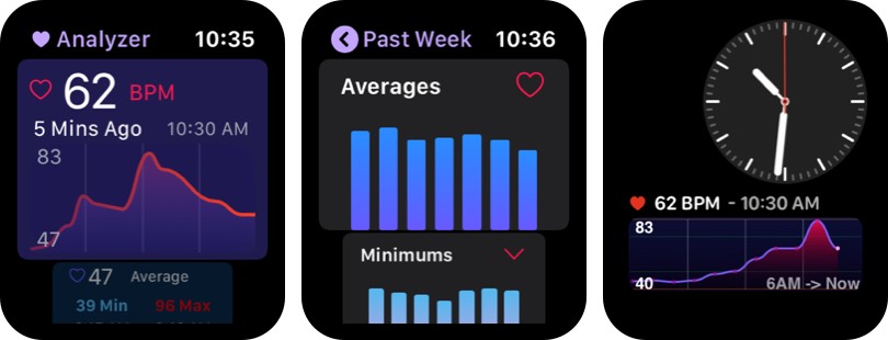 Heart Analyzer Apple Watch App Screenshot