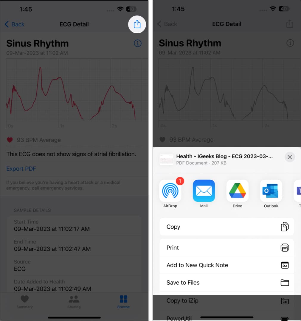 Share ECG results with your doctor from iPhone