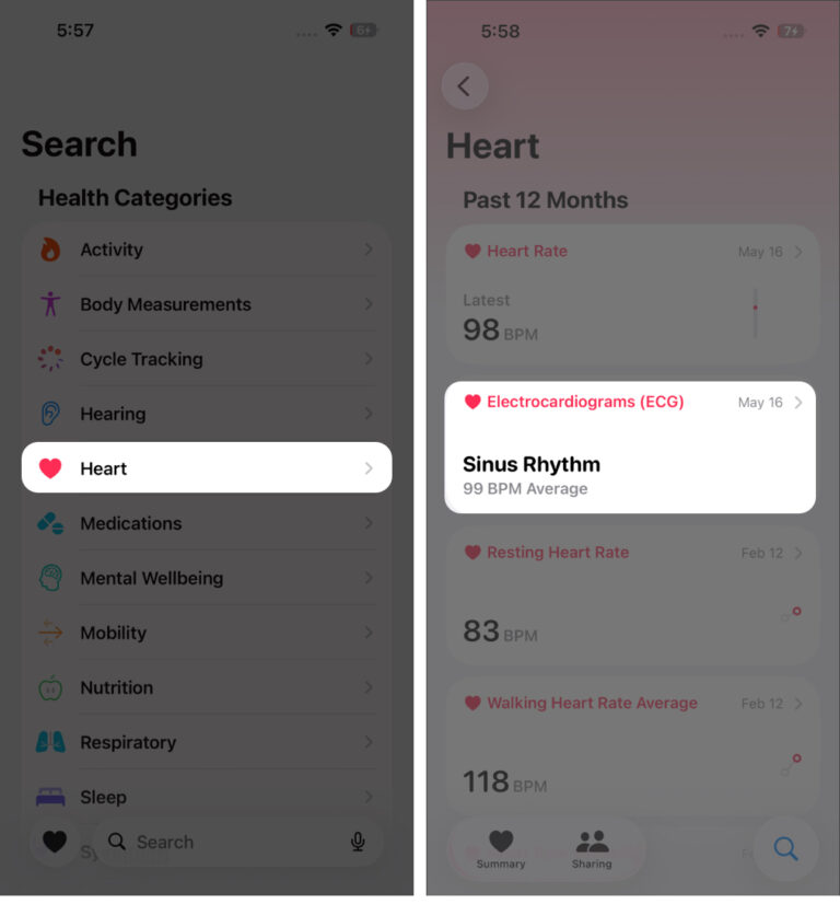 How to Take ECG Reading on Apple Watch – iGeeksBlog